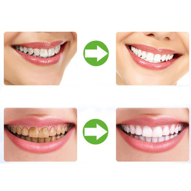 2 pezzi termoformatura paradenti dentale vassoi per sbiancamento dei denti igiene orale