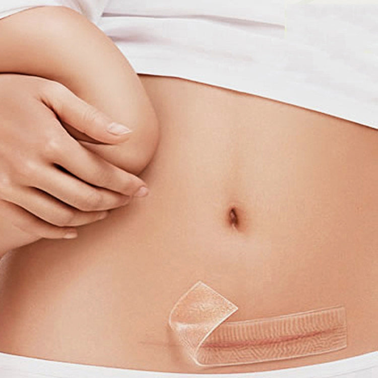 Il cerotto per terapia con cicatrici in gel di silicone organico può essere lavato e riutilizzato