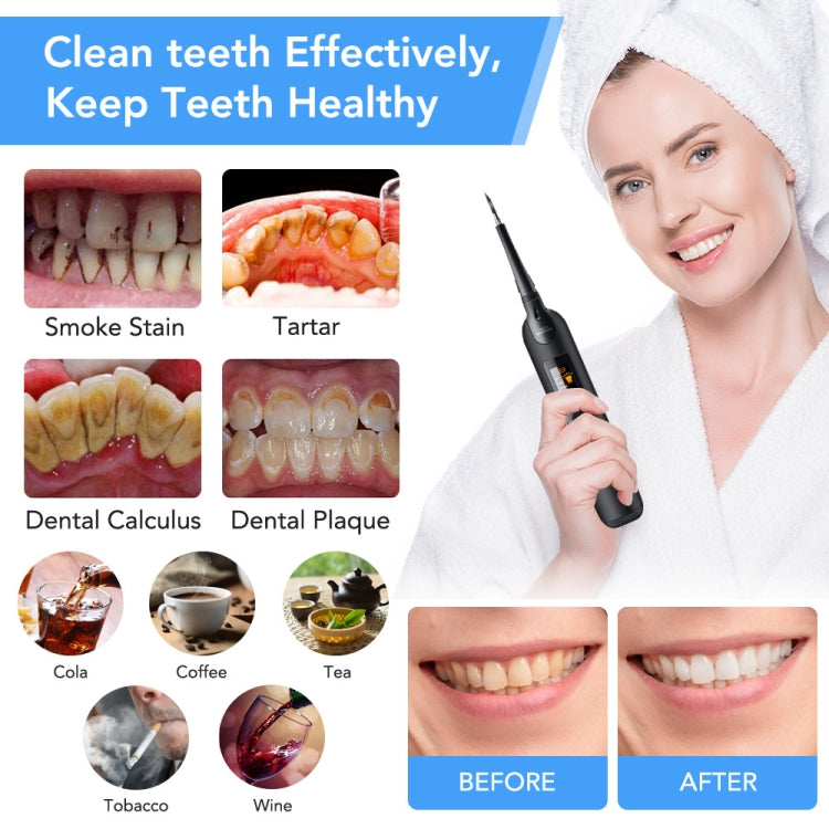Pulizia dentale e scaler Strumento dentale portatile elettrico per la cura della casa Strumento dentale di bellezza