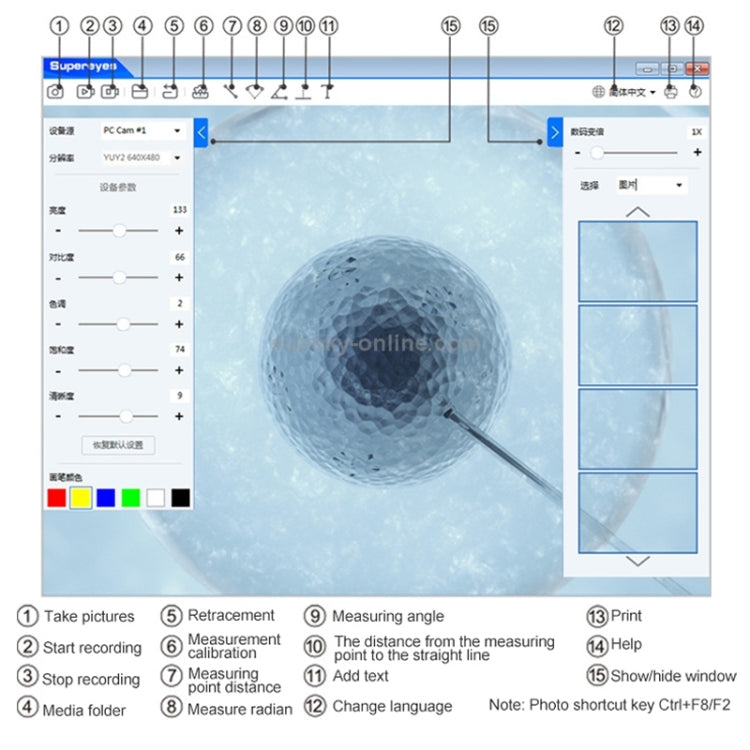 Supereyes Y001 + Endoscopio elettronico orale per gola nasale con tubo focalizzabile da 4 mm, Y001+