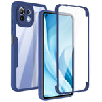 Acrilico + TPU Custodia per telefono antiurto a copertura totale a 360 gradi, For Xiaomi Mi 11, For Xiaomi Mi 11 Lite, For Xiaomi Mi 11T / 11T Pro, For Xiaomi Redmi Note 11 5G China