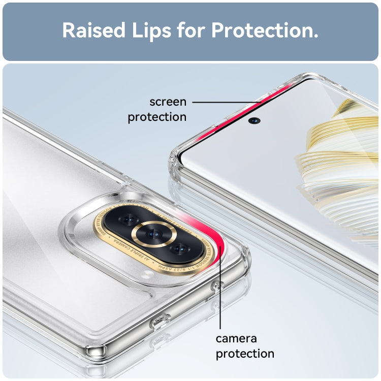Custodia per telefono in acrilico + TPU serie colorata, For Huawei nova 10, For Huawei nova 10 Pro