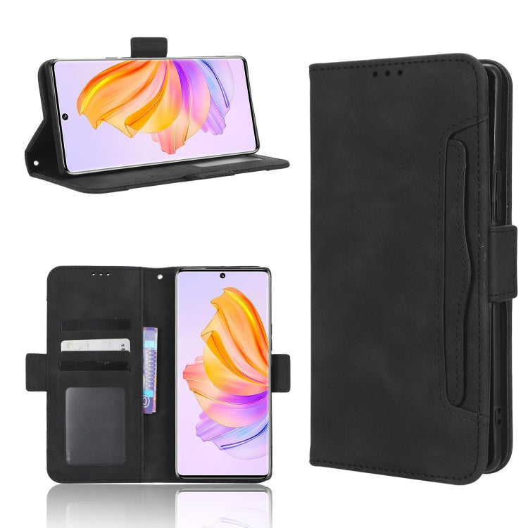 Custodia per telefono in pelle con slot per schede di consistenza al polpaccio, For Blackview BV5200, For Honor 80 SE 5G, For Honor 80 5G, For Honor 80 Pro 5G