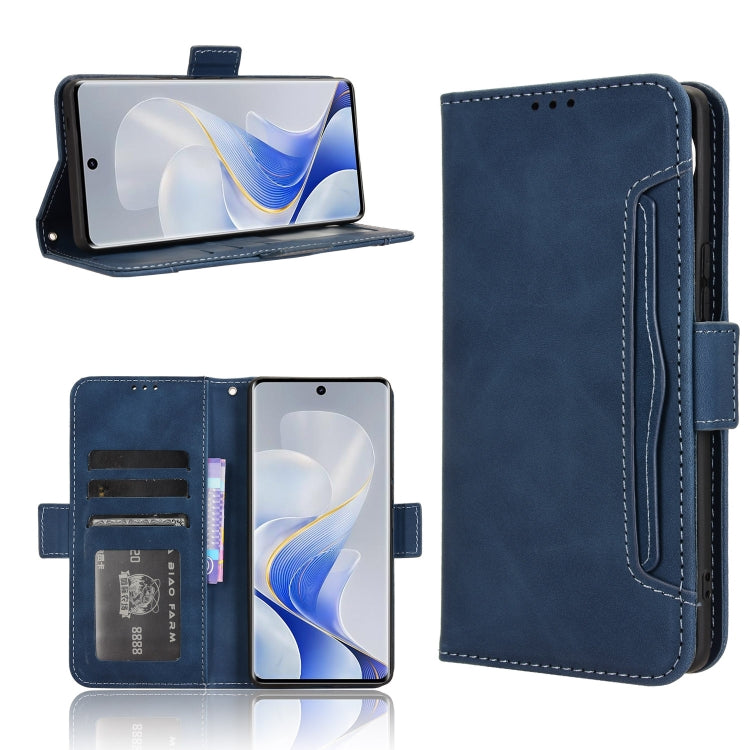 Custodia per telefono in pelle con slot per schede di consistenza al polpaccio, For vivo T3 Pro 5G / iQOO Z9S Pro 5G, For vivo V30e 5G / V40 Lite 5G, For vivo Y58 5G, For vivo S19 Pro 5G / V40 5G