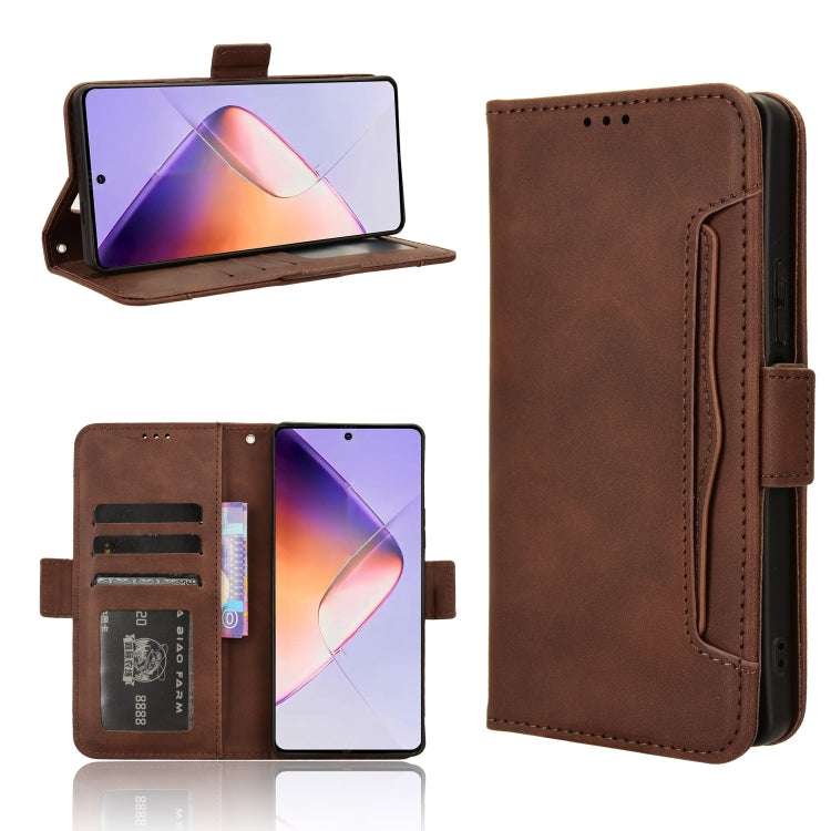 Custodia per telefono in pelle con slot per schede di consistenza al polpaccio, For Infinix Note 40 Pro 5G, For Infinix Note 40 4G, For Infinix Hot 40 4G, For Infinix Hot 40i 4G