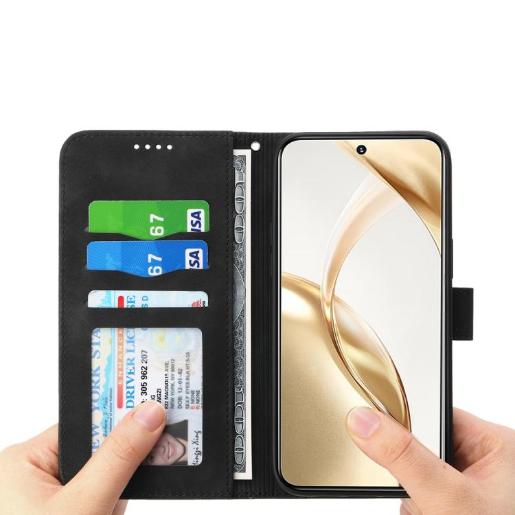 Dierfeng Dream Line TPU + Custodia per telefono in pelle PU, For OPPO Reno14 Global / Reno14 F 5G, For OPPO A5x 5G / A3 4G / 5G / A3x 4G / 5G, For OPPO A5 5G Global / A3 Pro 5G, For OPPO A5 PRO 5G Global