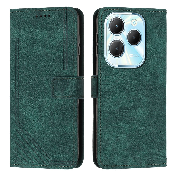 Custodia per telefono in pelle con motivo a righe Skin Feel con cordino, For Infinix Note 40 4G, For Infinix Hot 40 / 40 Pro, For Infinix Hot 40i, For Infinix Smart 8
