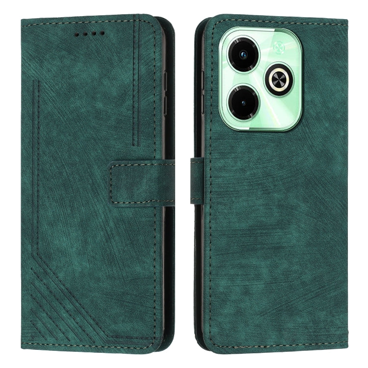 Custodia per telefono in pelle con motivo a righe Skin Feel con cordino, For Infinix Note 40 4G, For Infinix Hot 40 / 40 Pro, For Infinix Hot 40i, For Infinix Smart 8