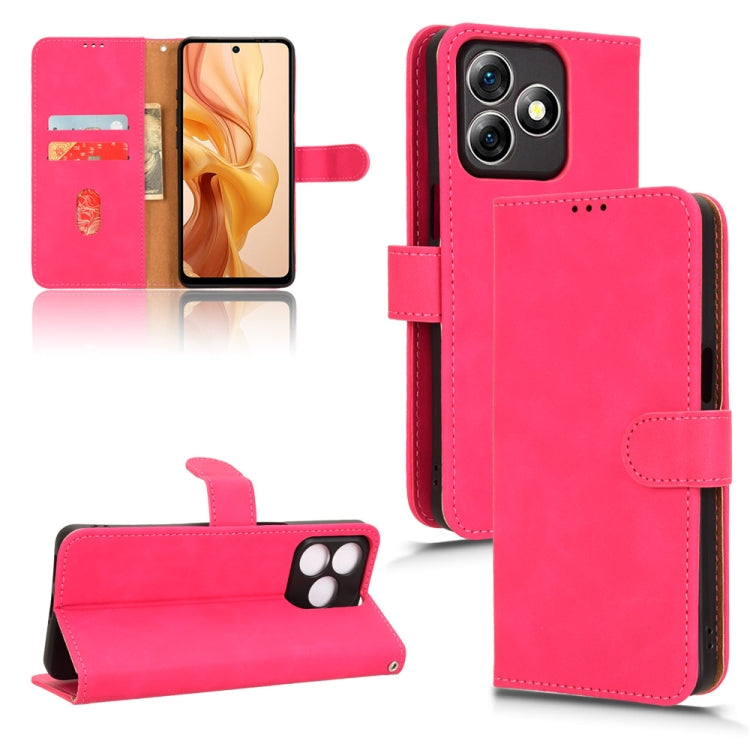 Custodia per telefono in pelle con vibrazione magnetica Skin Feel, For Ulefone Note 18 Ultra, For Ulefone Note 15, For Ulefone Note 16 Pro