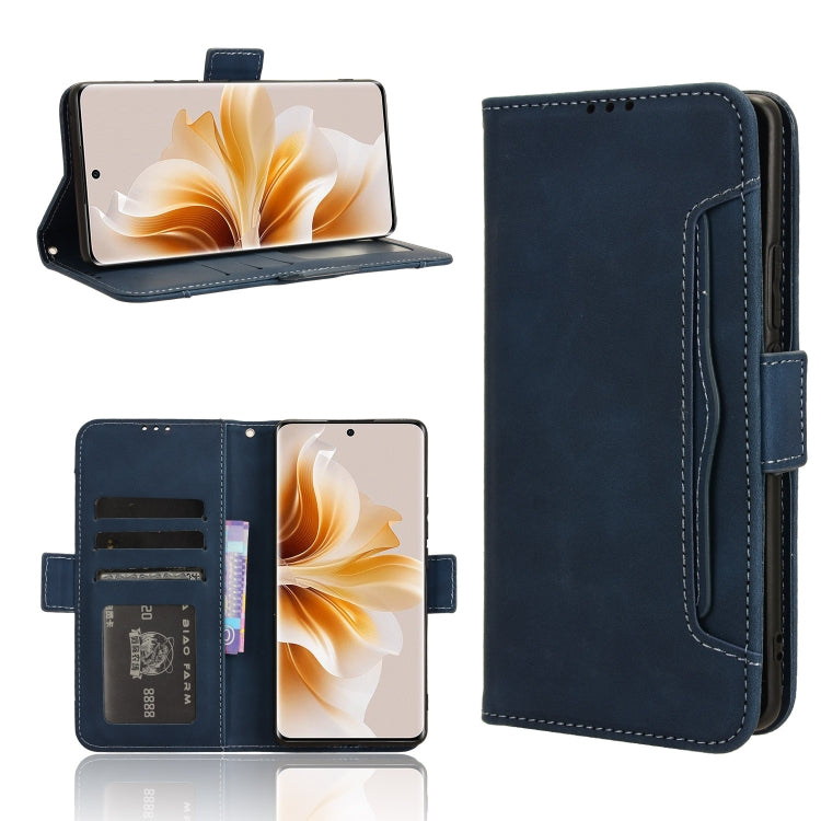 Custodia per telefono in pelle con slot per schede di consistenza al polpaccio, For OPPO Reno11 Pro 5G Global, For OPPO Find X7 Ultra 5G, For OPPO A79 5G / A2 5G, For OPPO Find N3 / OnePlus Open