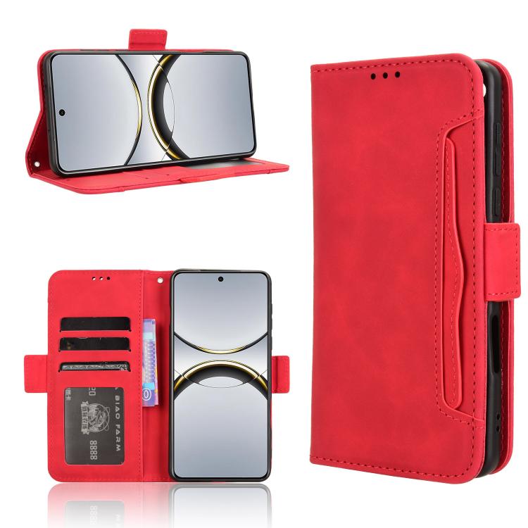 Custodia per telefono in pelle con slot per schede di consistenza al polpaccio, For OPPO A78 4G, For OPPO Find X8 Pro, For OPPO Reno7 A