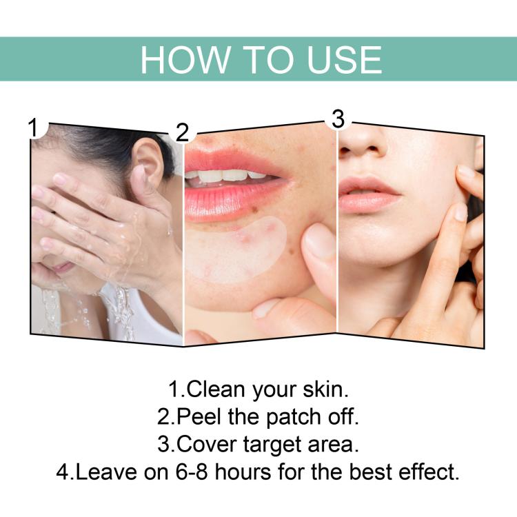 Patch idrocolloidali traspiranti per acne EELHOE