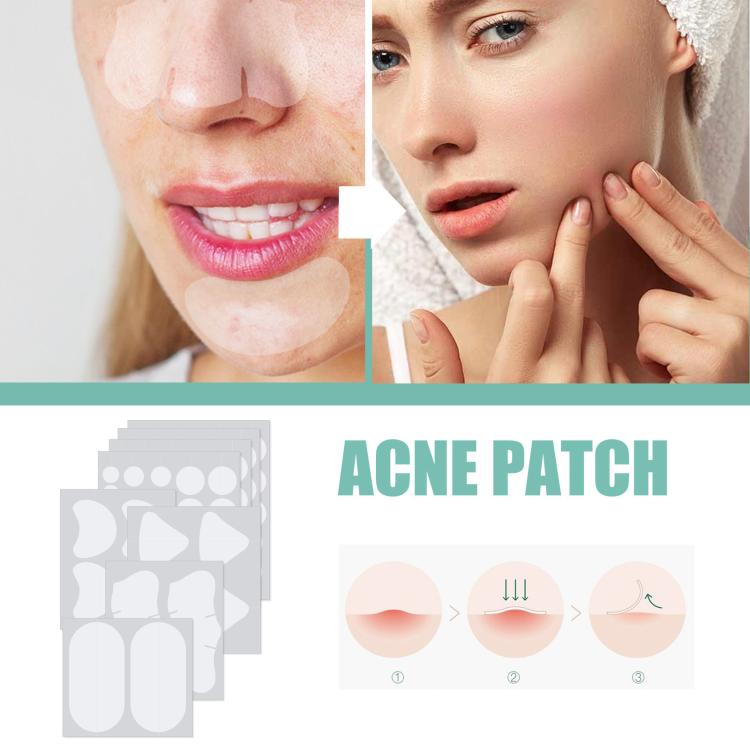 Patch idrocolloidali traspiranti per acne EELHOE