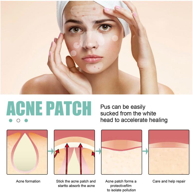 Patch idrocolloidali traspiranti per acne EELHOE