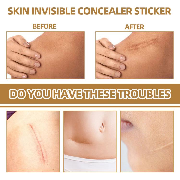 Cerotto impermeabile per cicatrici, acne e segni della pelle