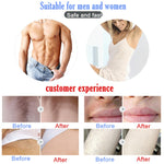 Dispositivo IPL per depilazione laser indolore domestica