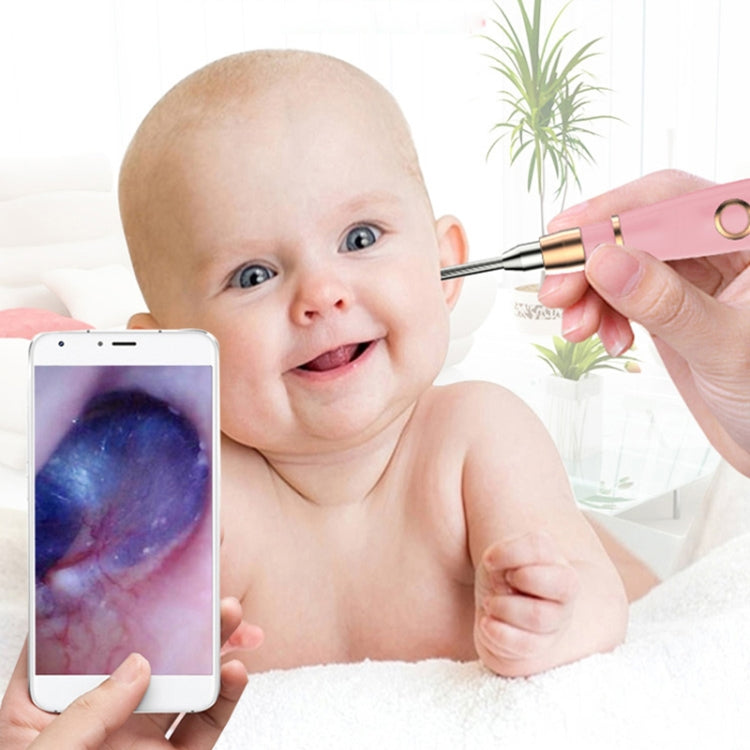 Endoscopio WiFi 720P per pulizia orecchio con cucchiaio