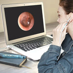 Endoscopio USB 3 in 1 HD 0,3MP per Android, Windows e Mac