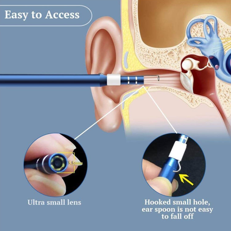 i95 3 in 1 USB Ear Scope Ispezione HD 0,3 MP Cucchiaio auricolare visivo per telefoni Android OTG e PC e MacBook, cavo lungo 1,75 m, 3 in 1 White  0.3MP