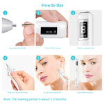 Xpreen XPRE061 Rimuovi macchie scure e verruche con LED