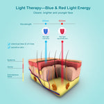 Xpreen Maschera viso terapia luce blu e rossa per acne