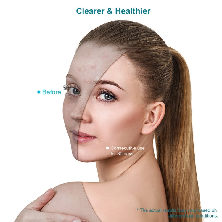 Xpreen Maschera viso terapia luce blu e rossa per acne