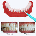 Lucidatore denti elettrico ricaricabile USB 5 velocità