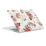 Custodia protettiva rosa per MacBook Pro 15.4