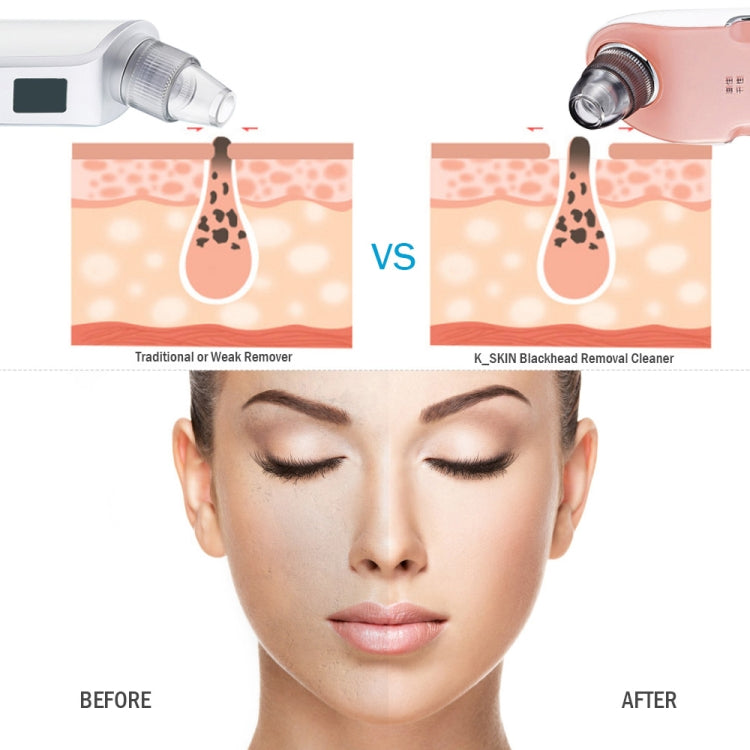 K-SKIN Macchina pulizia viso ricaricabile 3 livelli intensità