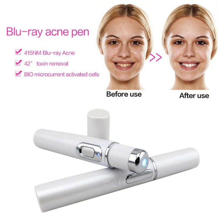 Penna laser K-SKIN KD-7910 per terapia acne e rughe