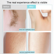 K_SKIN KD506A Epilatore per uso domestico Strumento per la depilazione dei fotoni 5 livelli di intensità della luce per guance ascella gamba posteriore