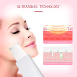 K-SKIN KD8070 scrubber elettrico viso ad ultrasuoni