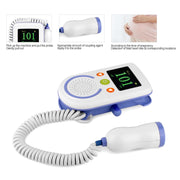 A100D Digitale Doppler Fetale Ad Ultrasuoni Rilevatore di Battito Cardiaco Del Bambino Monitor Stetoscopio Doppler Fetale Tascabile Prenatale Ricaricabile
