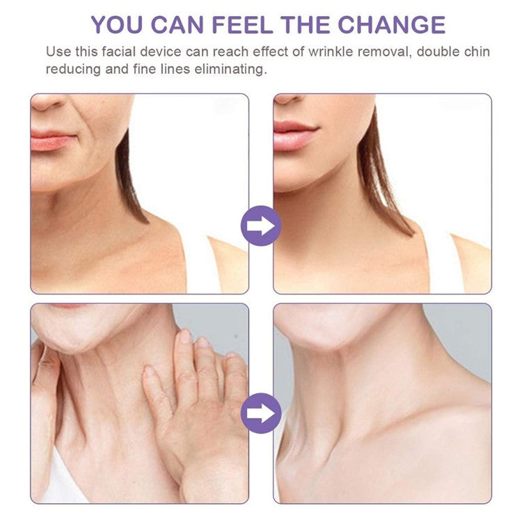 Massaggiatore elettrico per il collo del delfino, rimozione delle rughe, vibrazione manuale, massaggio al viso, strumento per strumenti di bellezza