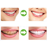 2 pezzi termoformatura paradenti dentale vassoi per sbiancamento dei denti igiene orale