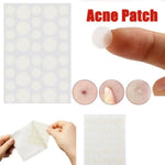 Set 3 strumenti per acne con cerotti per cicatrici