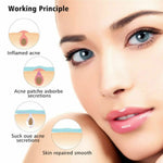 Set 3 strumenti per acne con cerotti per cicatrici