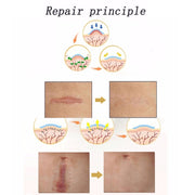 Il cerotto per terapia con cicatrici in gel di silicone organico può essere lavato e riutilizzato