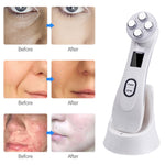 Penna di bellezza viso con radiofrequenza e LED Photon