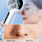 Attrezzatura per la bellezza della casa a bolle piccole Strumento elettrico multifunzionale per l'aspirazione dei punti neri Detergente per i pori del viso, FY-SX-128A