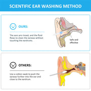Ear Wash Ball Ear Wash Set Strumento per la pulizia del cerume