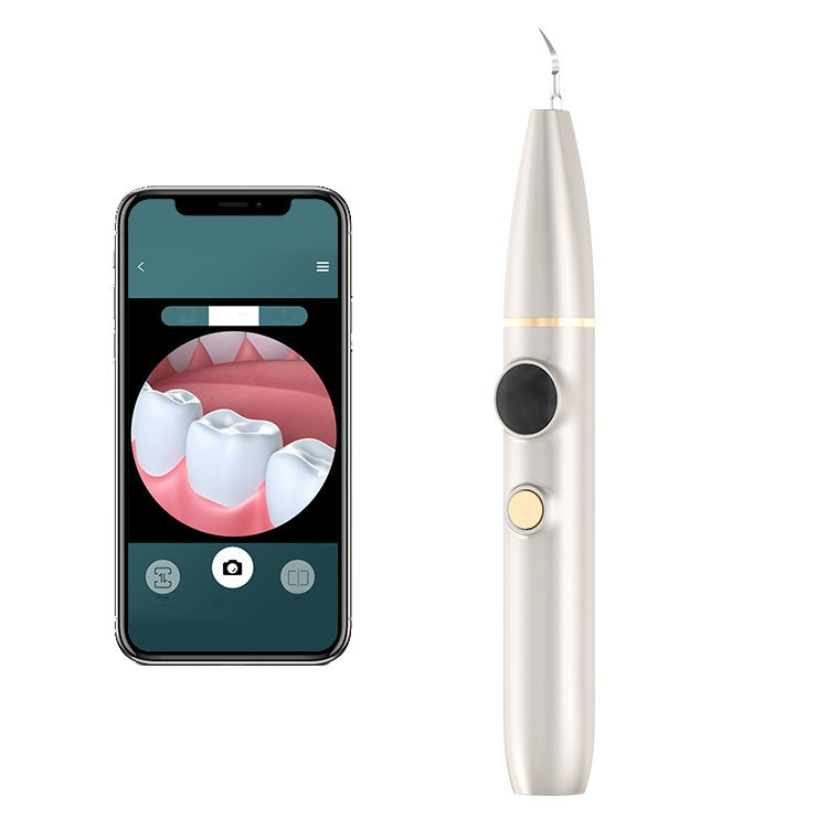 Rimozione del tartaro e del calcolo Pulizia orale Scaler ultrasonico Electric Visual Scaler, White, Green, Champagne