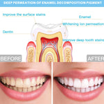 Sistema di sbiancamento dentale del dispositivo di sbiancamento dei denti a 16 LED con temporizzazione di 25 minuti controllata da filo, Wire-Controlled