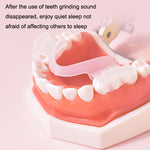 Apparecchio ortodontico Y-Kelin Bretelle di simulazione in silicone Bretelle antimolari per la notte, Transparent