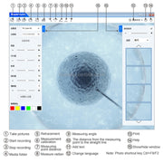 Supereyes Y001 + Endoscopio elettronico orale per gola nasale con tubo focalizzabile da 4 mm, Y001+