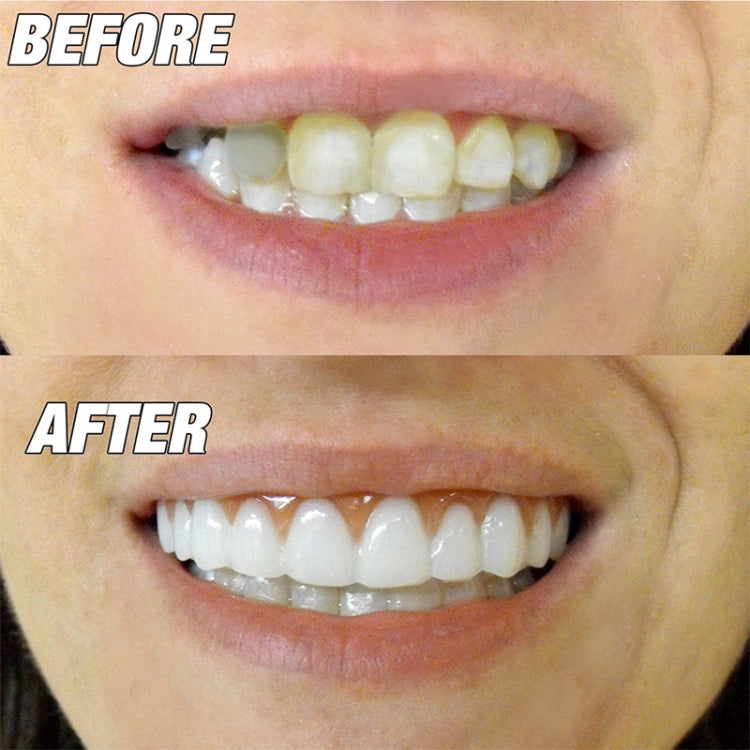 5pcs Copertura per Denti Finti in Silicone Comfort Fit