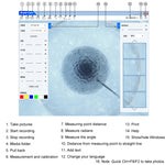 Dermatoscopio digitale 5MP con ingrandimento 1-500X