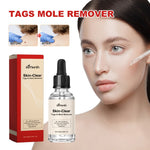 EELHOE 30 ml/bottiglia anti talpa e verruca liquido per rimuovere macchie scure essenza per la pelle