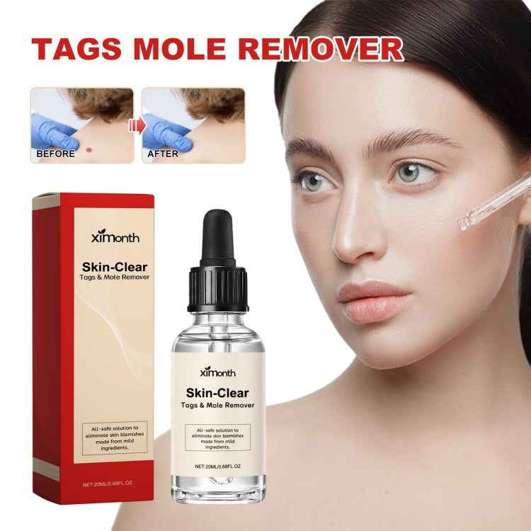 EELHOE 30 ml/bottiglia anti talpa e verruca liquido per rimuovere macchie scure essenza per la pelle
