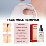EELHOE 30 ml/bottiglia anti talpa e verruca liquido per rimuovere macchie scure essenza per la pelle